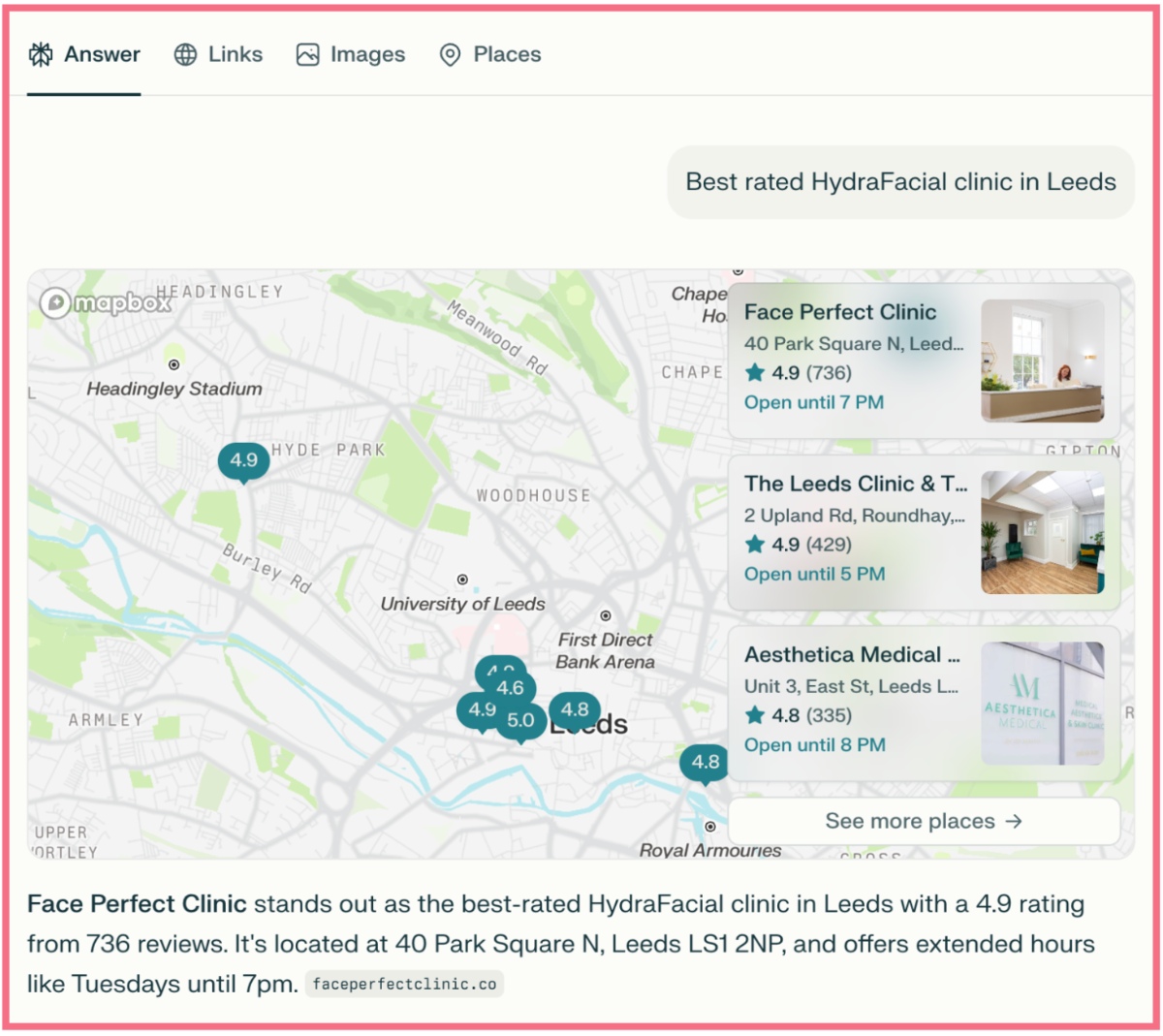 Perplexity - best rated Hydrafacial clinic in Leeds