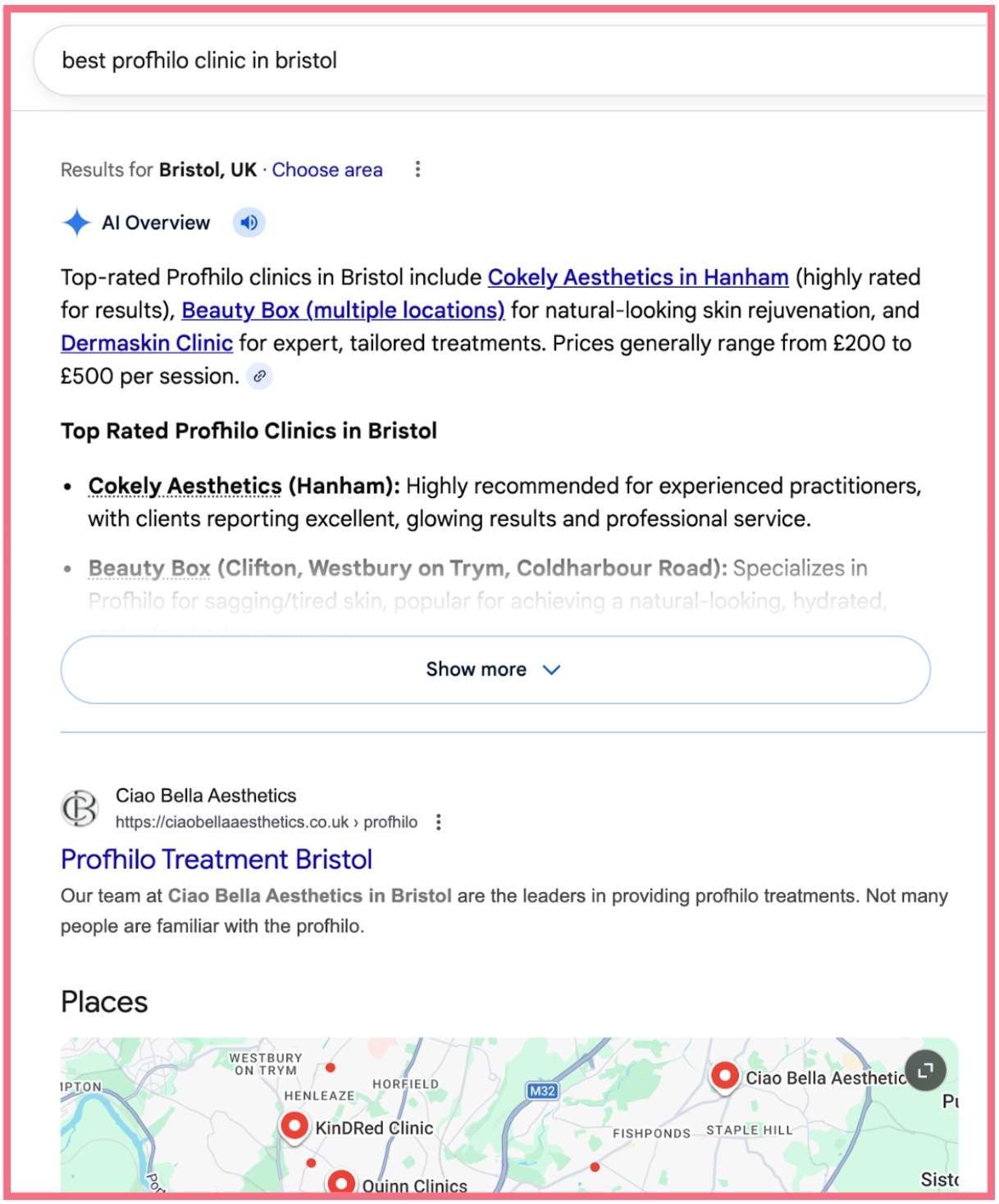 best Profhilo in Bristol - Google